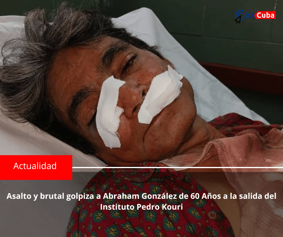 Asalto y brutal golpiza a Abraham González de 60 años a la salida del Instituto Pedro&nbsp;Kouri