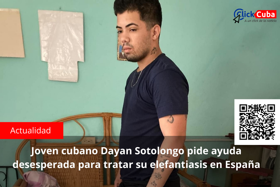 Joven cubano Dayan Sotolongo pide ayuda desesperada para tratar su elefantiasis en España