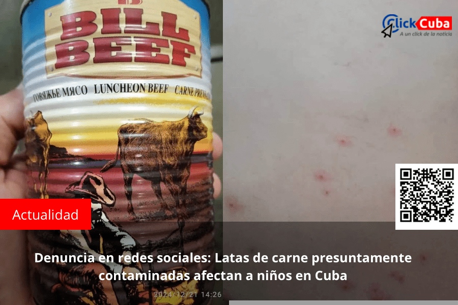 Denuncia en redes sociales: Latas de carne presuntamente contaminadas afectan a niños en&nbsp;Cuba
