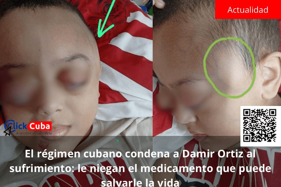 El régimen cubano condena a Damir Ortiz al sufrimiento: le niegan el medicamento que puede salvarle la&nbsp;vida