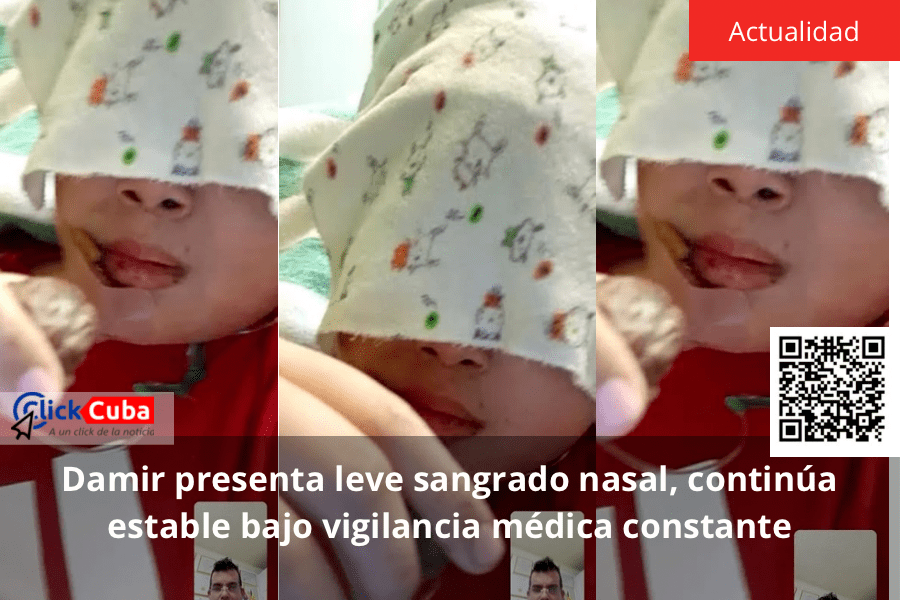 Damir presenta leve sangrado nasal, continúa estable bajo vigilancia médica&nbsp;constante