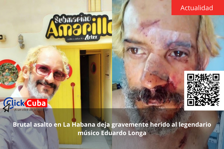 Brutal asalto en La Habana deja gravemente herido al legendario músico Eduardo Longa