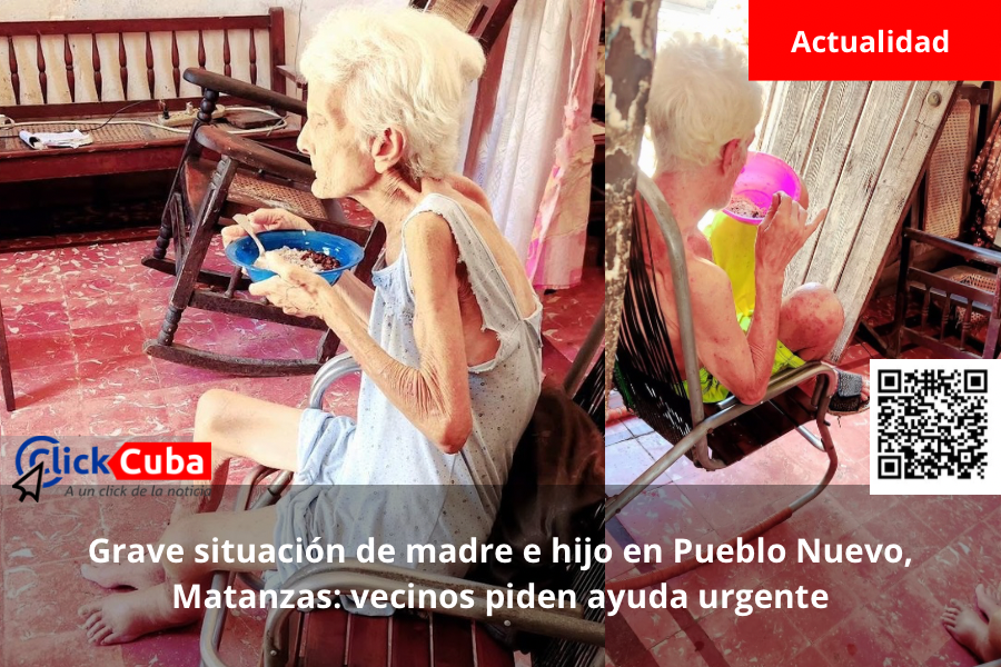Grave situación de madre e hijo en Pueblo Nuevo, Matanzas: vecinos piden ayuda&nbsp;urgente