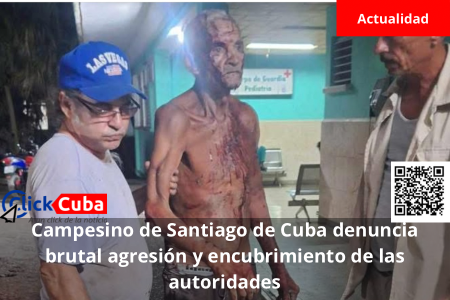 Campesino de Santiago de Cuba denuncia brutal agresión y encubrimiento de las&nbsp;autoridades