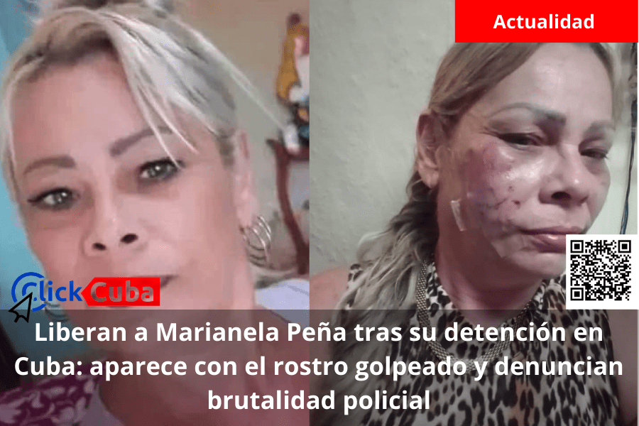 Liberan a Marianela Peña tras su detención en Cuba: aparece con el rostro golpeado y denuncian brutalidad&nbsp;policial