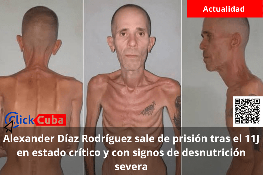 Alexander Díaz Rodríguez sale de prisión tras el 11J en estado crítico y con signos de desnutrición&nbsp;severa