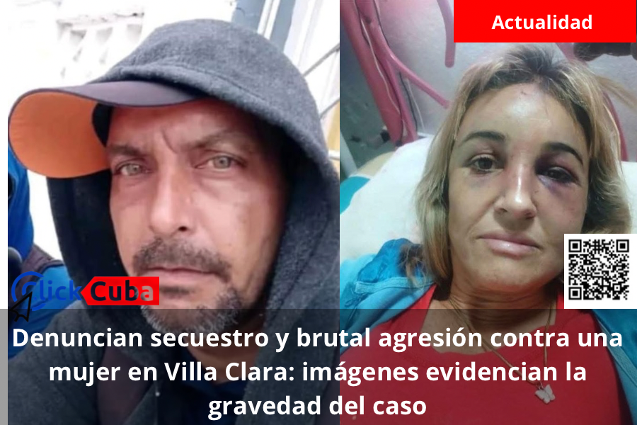 Denuncian secuestro y brutal agresión contra una mujer en Villa Clara: imágenes evidencian la gravedad del caso