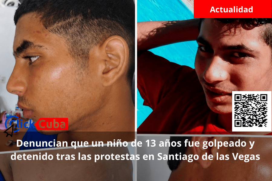 Denuncian que un niño de 13 años fue golpeado y detenido tras las protestas en Santiago de las Vegas