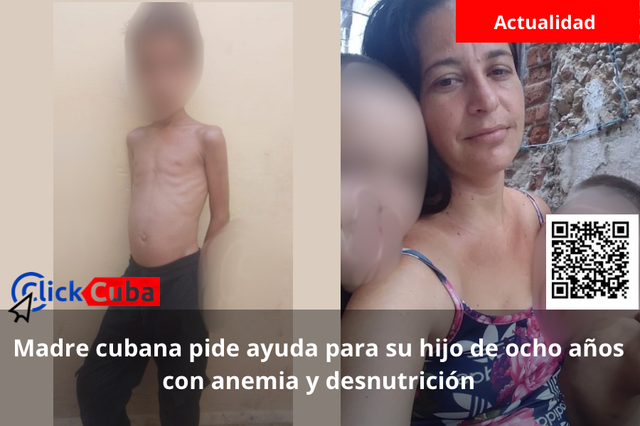 Madre cubana pide ayuda para su hijo de ocho años con anemia y desnutrición